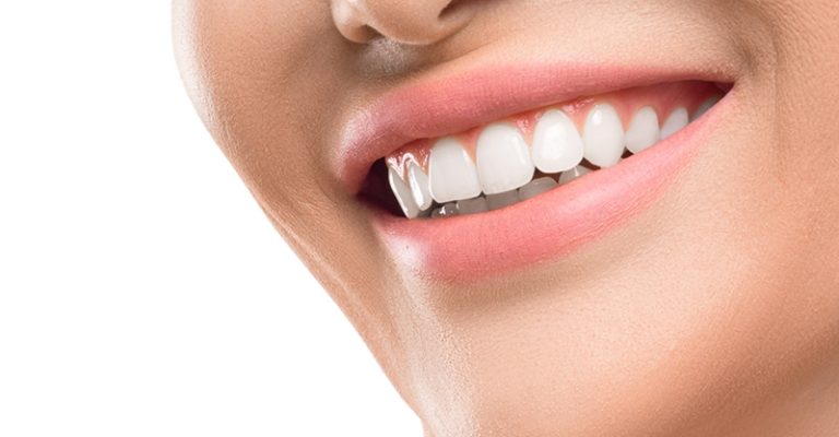 dental-implants-m