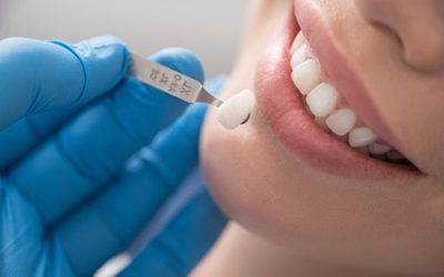 painless-dental-crown